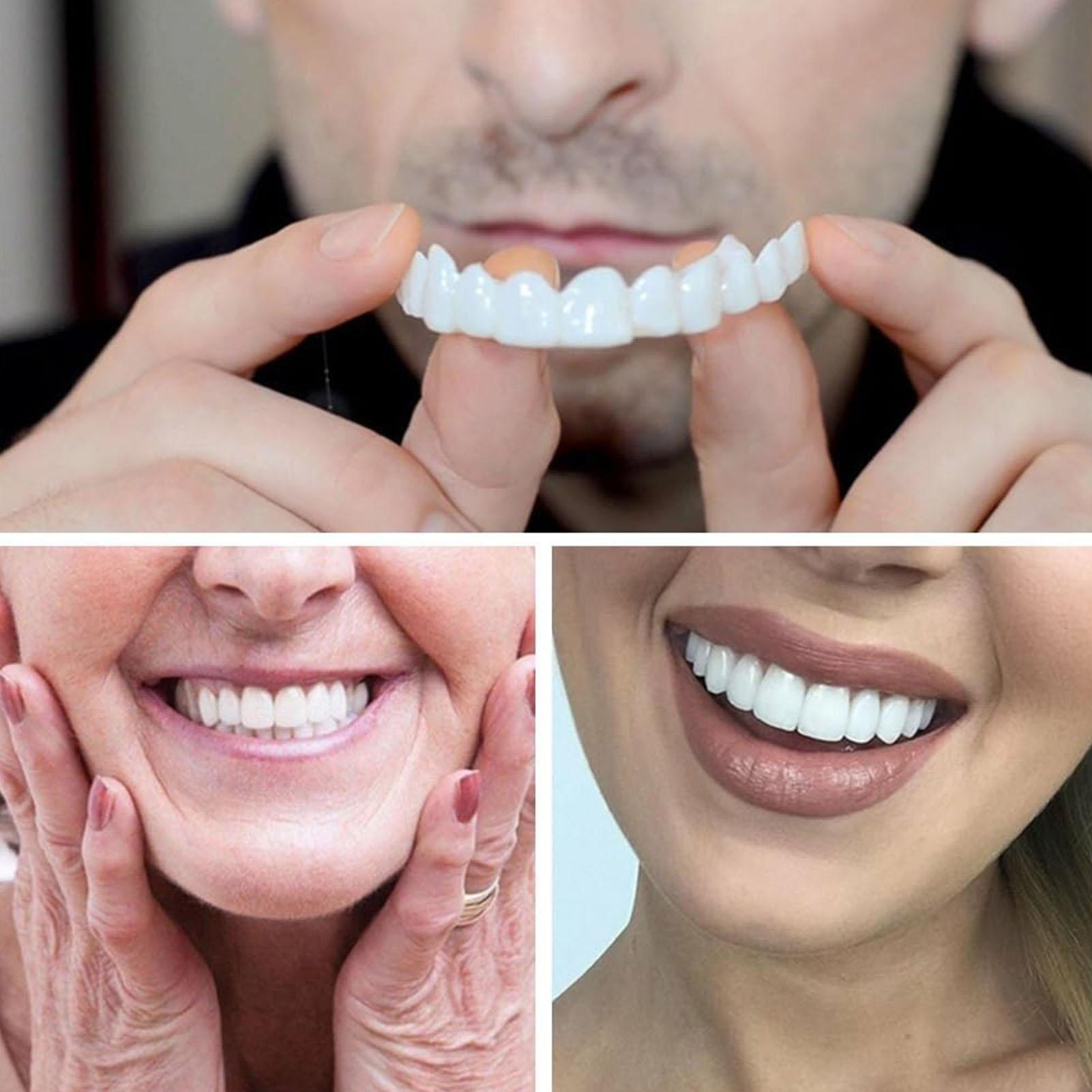 Teeth Whitening In Office - ชุดฟันปลอมแบบติดทับ ฟันปลอมชั่วคราว ฟันขาว ฟันทดแทนชั่วคราว สำหรับผู้ชายและผู้หญิง