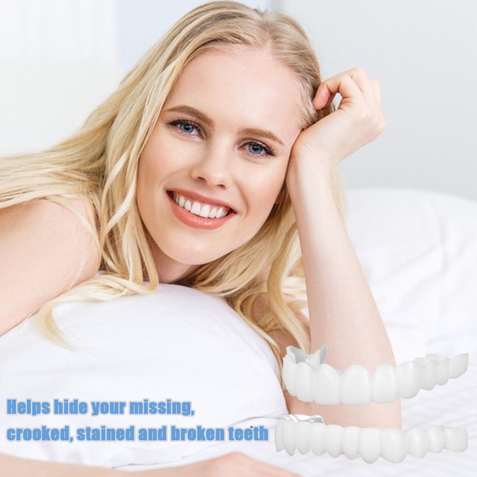 ชุดฟันปลอมแบบติดทับ ฟันปลอมชั่ - Teeth Whitening In Office บทวิจารณ์และราคา