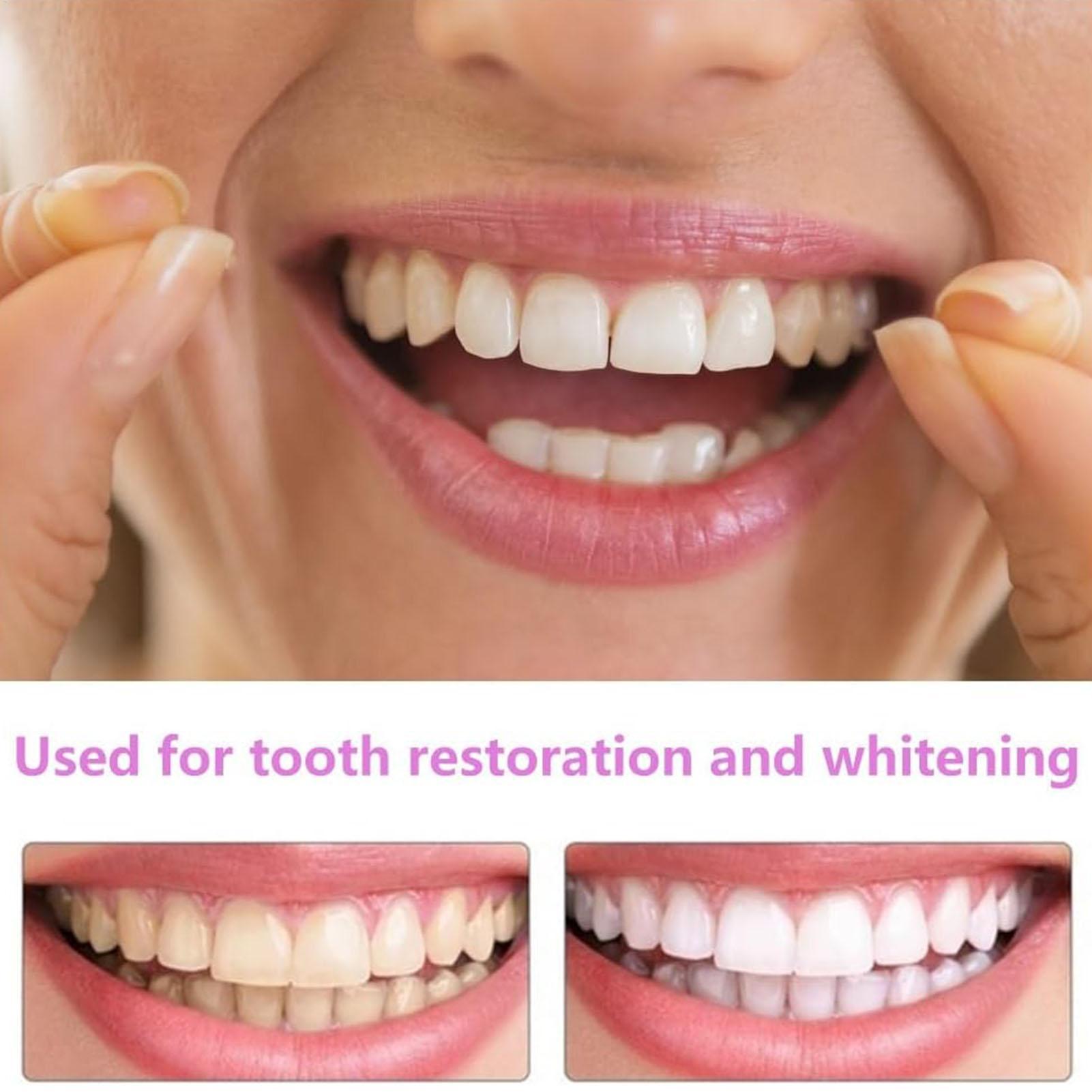 ชุดฟันปลอมแบบติดทับ ฟันปลอมชั่ - Teeth Whitening In Office บทวิจารณ์และราคา