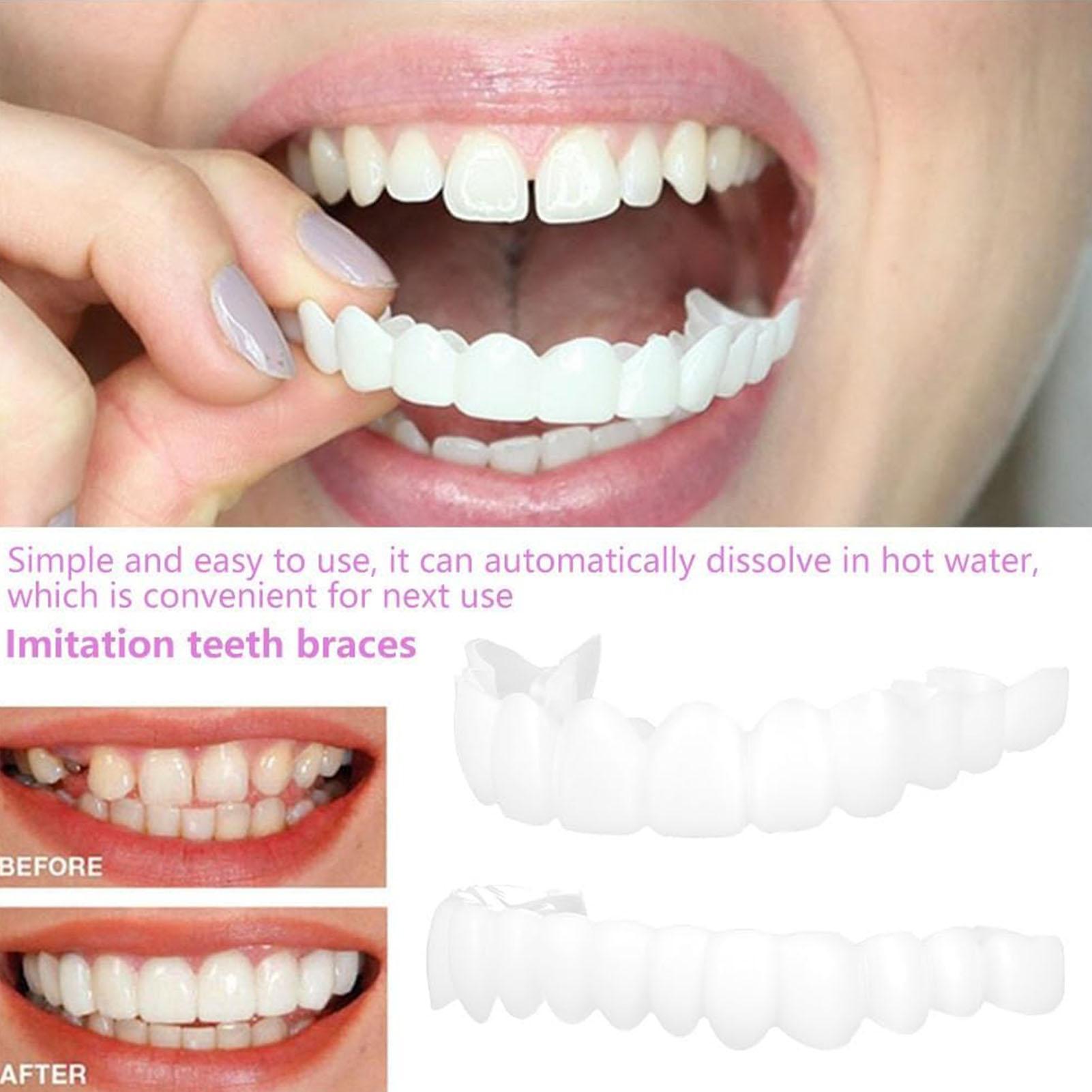 ชุดฟันปลอมแบบติดทับ ฟันปลอมชั่ - Teeth Whitening In Office บทวิจารณ์และราคา