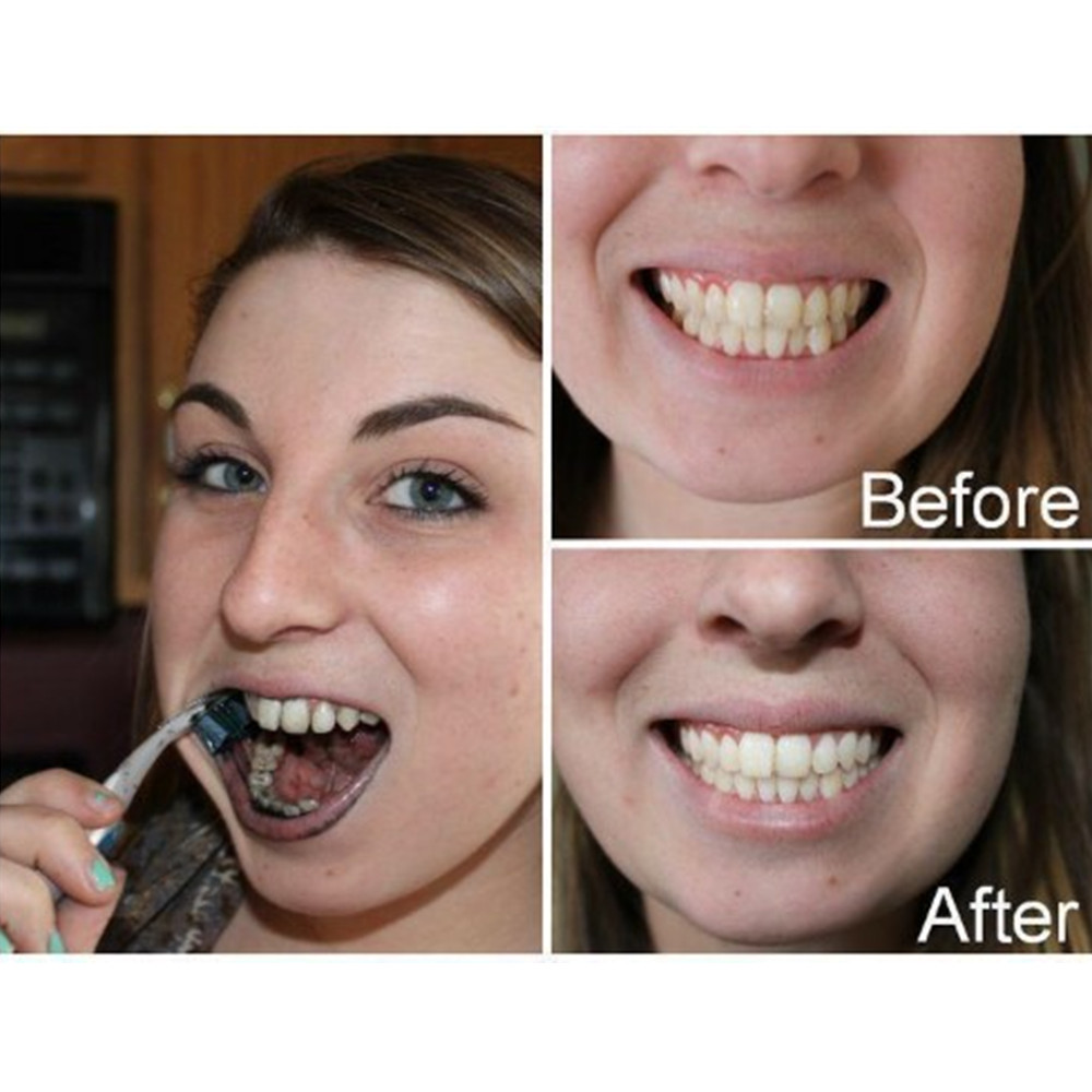 ถ่านไม้ไผ่ฟันฟันทันตกรรมสูตร L - Teeth Whitening Charcoal Powder บทวิจารณ์และราคา
