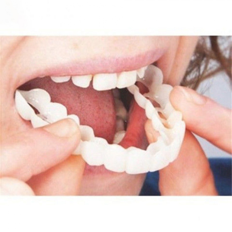 ฟันปลอมแบบสวม Perfect Fit ฟอกส - Teeth Whitening Veneers บทวิจารณ์และราคา