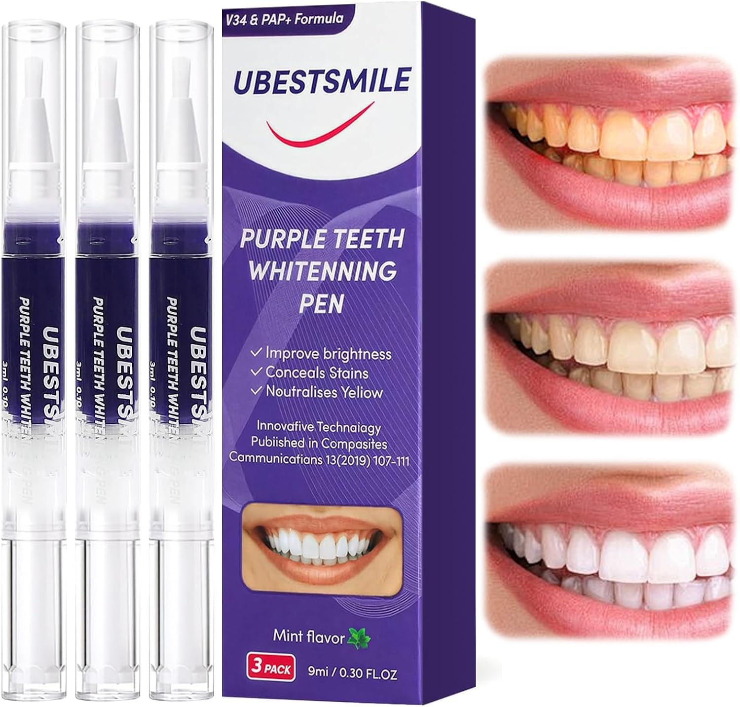ยูเบสท์สไมล์ V34&PAP+ ฟอร์มูล่ - Teeth Whitening Pen บทวิจารณ์และราคา