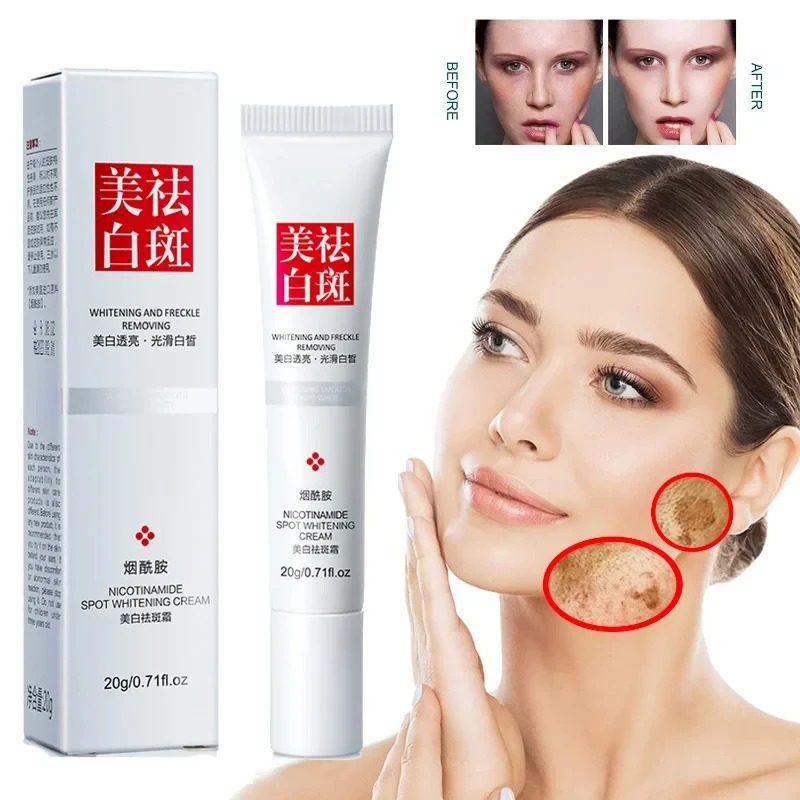 จางลงและปรับปรุงกระจุดด่างดําค - Charcoal Whitening Paste บทวิจารณ์และราคา