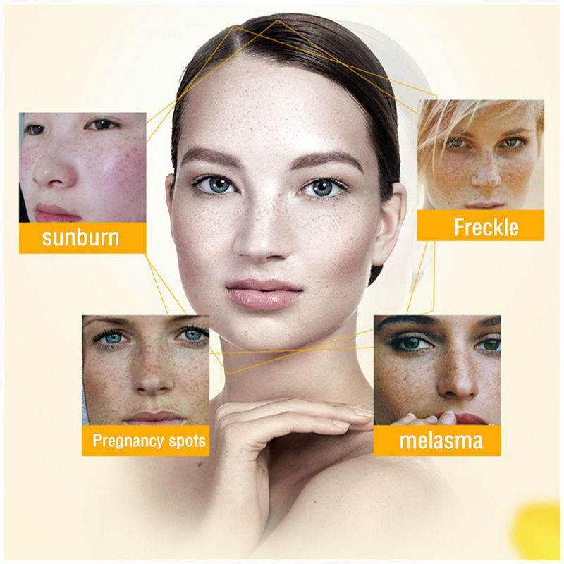 Dimollaure Whitening Freckle C - Charcoal Whitening Paste บทวิจารณ์และราคา