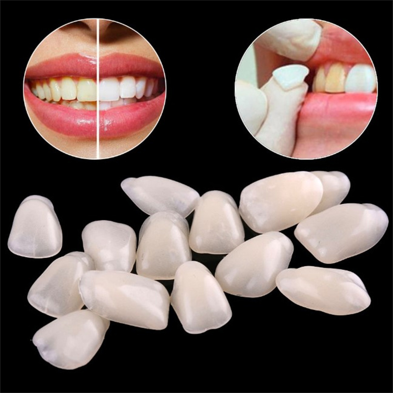 วีเนียร์ฟันชั่วคราว - แผ่นปิดฟ - Teeth Whitening Veneers บทวิจารณ์และราคา