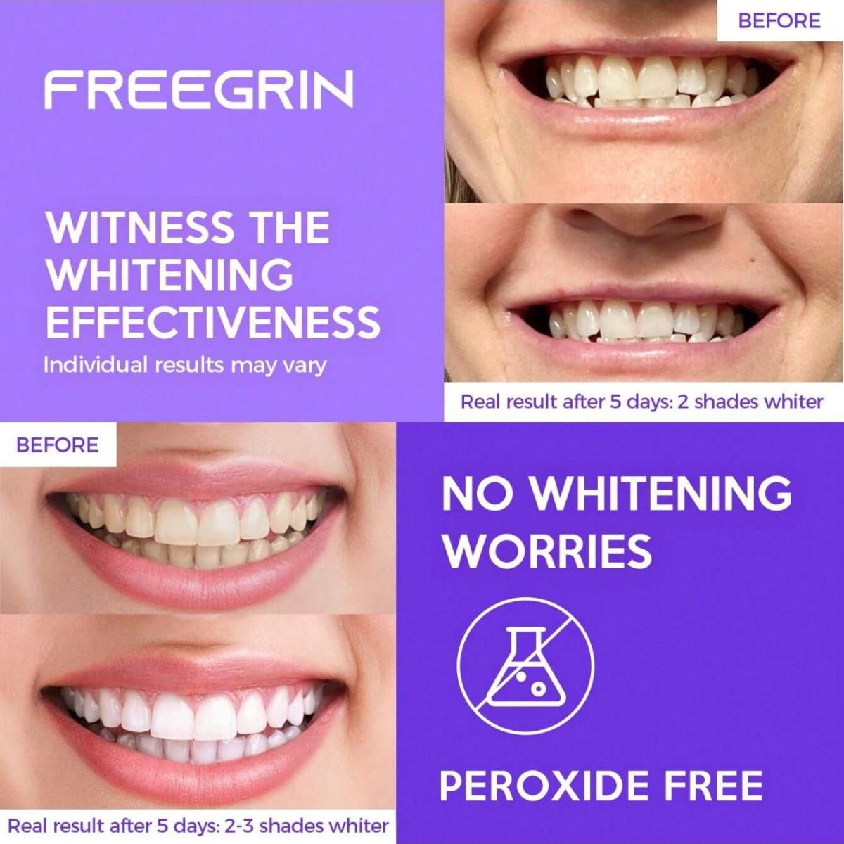 ดีลักซ์สติกเกอร์ฟอกสีฟัน 7/14/ - Teeth Whitening In Office บทวิจารณ์และราคา