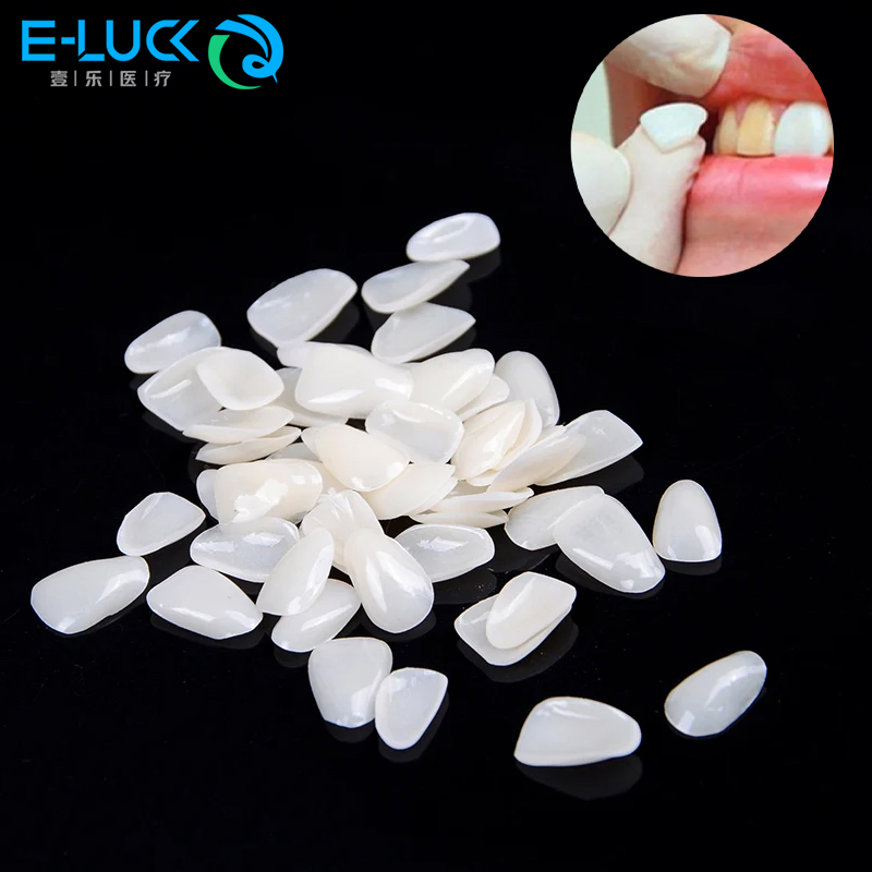 50 ชิ้นทันตกรรมฟันวีเนียร์ชั่ว - Teeth Whitening Veneers บทวิจารณ์และราคา
