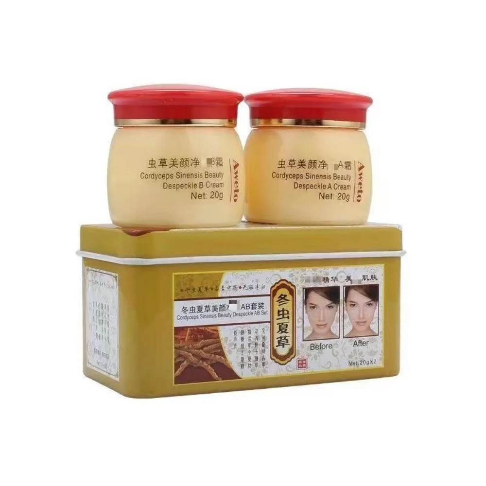 ครีมไวท์เทนนิ่งลดรอยสิว แอคเน่ - Charcoal Whitening Paste บทวิจารณ์และราคา
