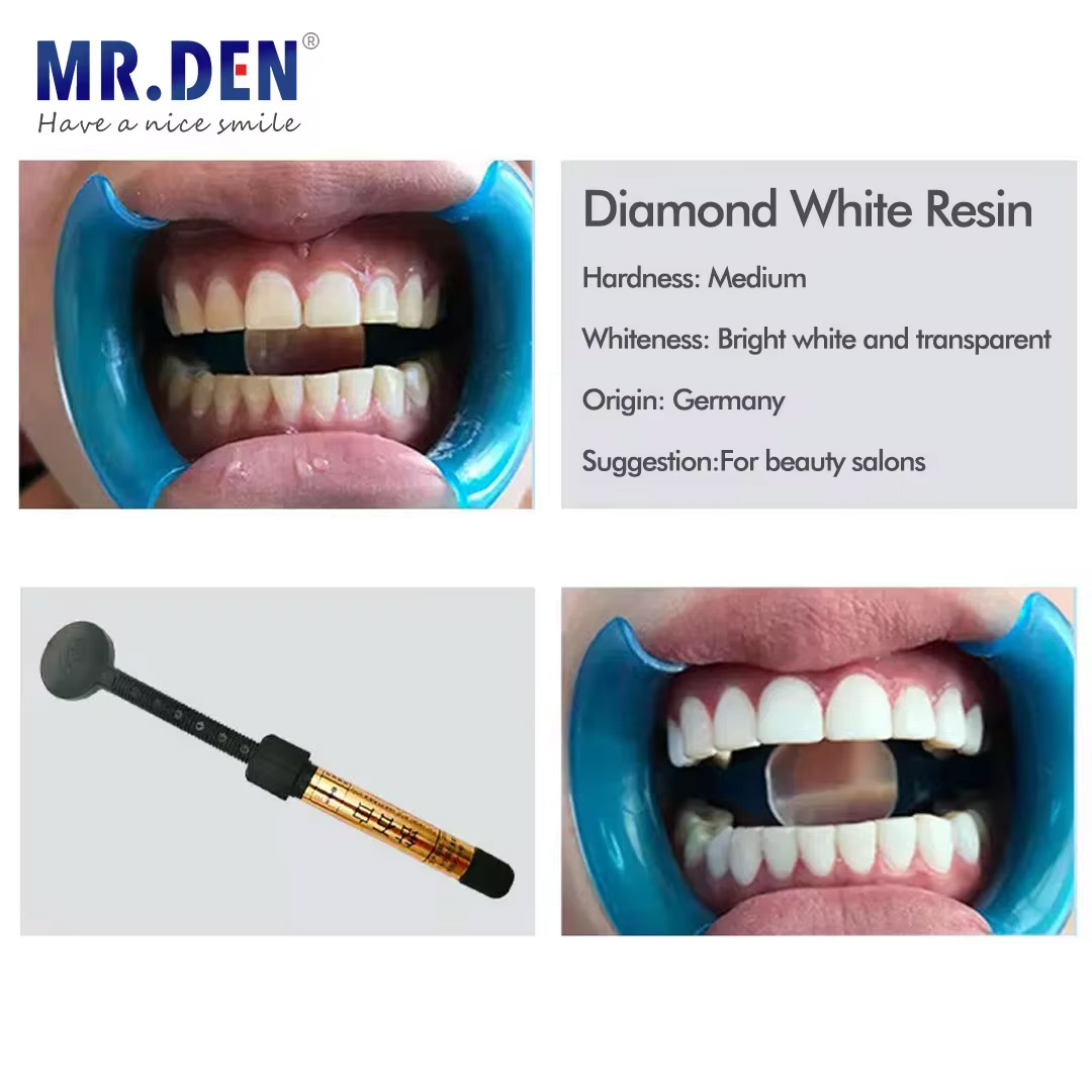 วัสดุเคลือบฟันนาโน เรซินสำหรับ - Teeth Whitening Veneers บทวิจารณ์และราคา