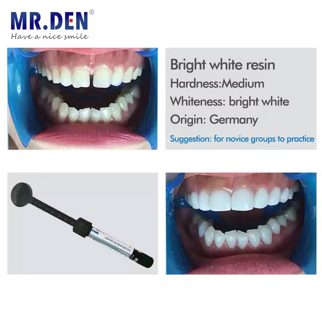 วัสดุเคลือบฟันนาโน เรซินสำหรับ - Teeth Whitening Veneers บทวิจารณ์และราคา