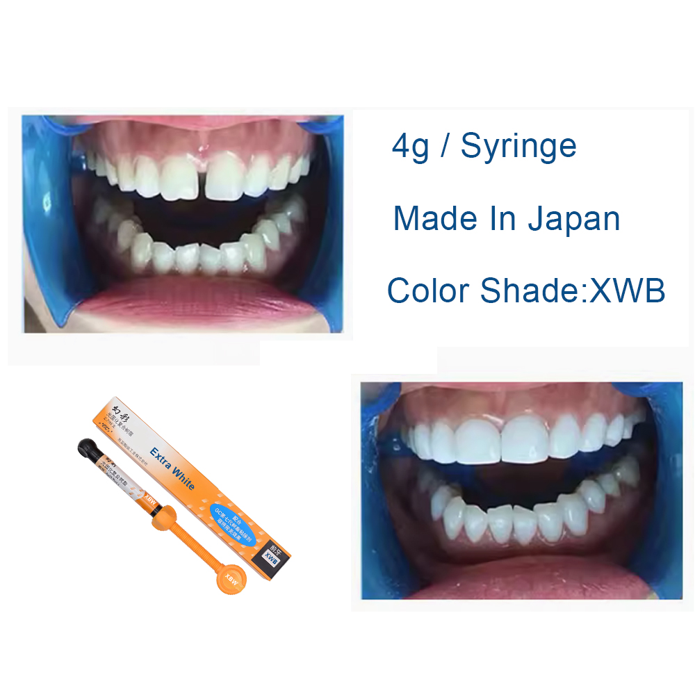 เรซินคอมโพสิตสำหรับงานทันตกรรม - Teeth Whitening Veneers บทวิจารณ์และราคา