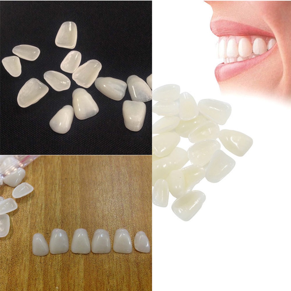 วีเนียร์ฟอกสีฟันแบบบางพิเศษ 70 - Teeth Whitening Veneers บทวิจารณ์และราคา